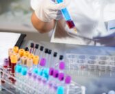 Aimed Alliance Releases Biomarker Testing Fact Sheet